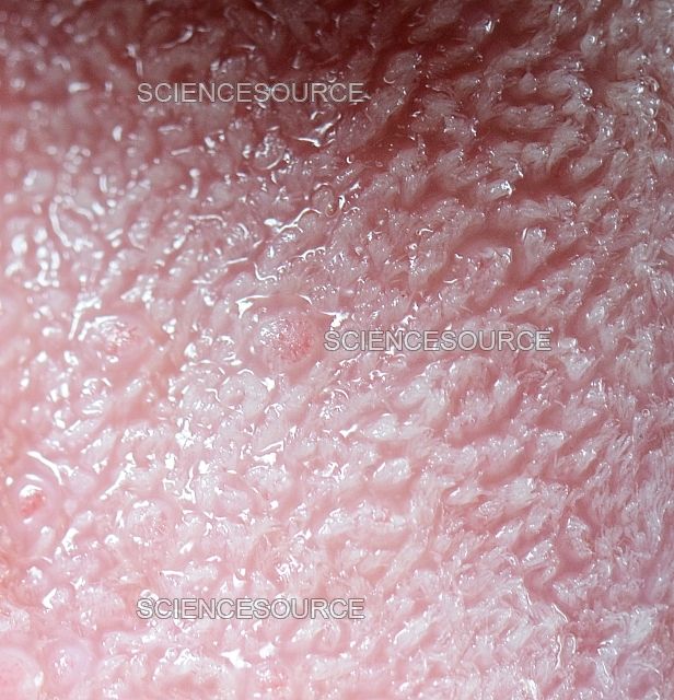 Nærbilde av overflaten på en mennesketunge med synlige papiller.